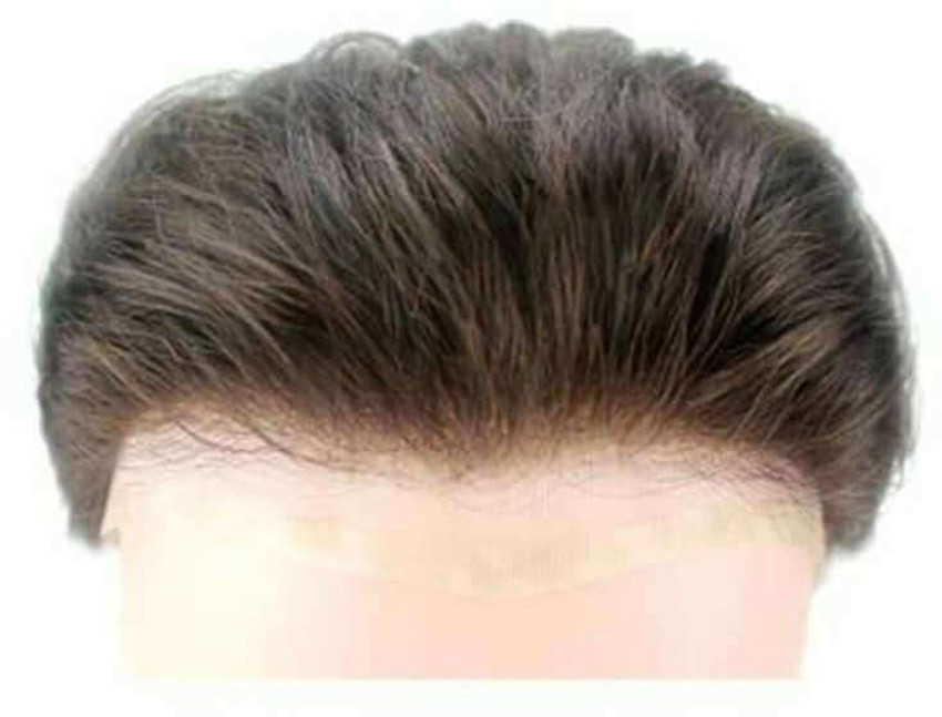 Update 139+ hair patch in vadodara super hot dedaotaonec