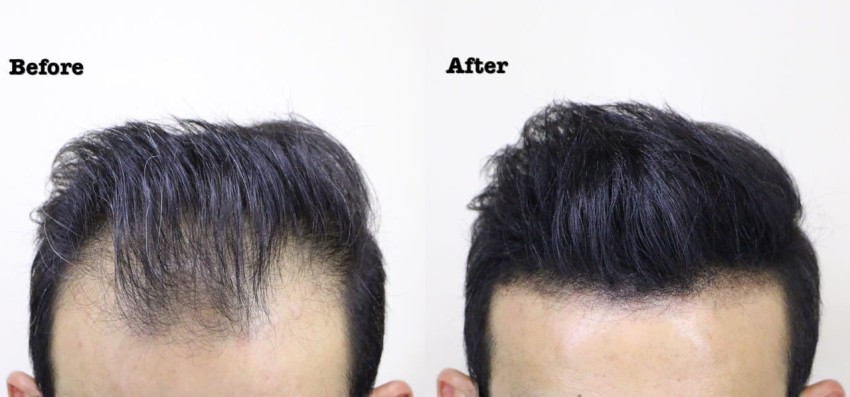 Hot Selling Barber Hair Fibers Bulk OEM Hair Loss Thick Fiber Hair Spray  Powder  China Thickening Fiber and Hair Thinning Building Fiber price   MadeinChinacom