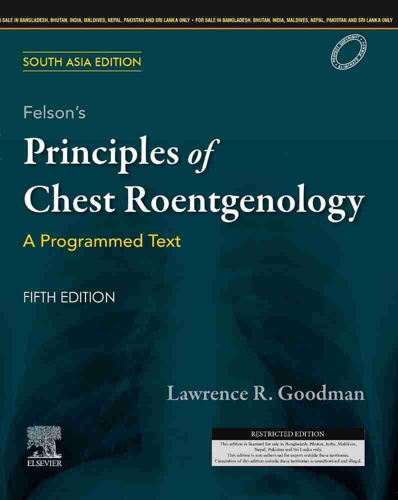 felson-s-principles-of-chest-