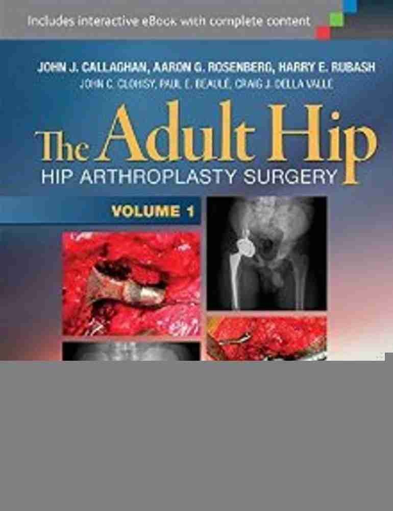 The Adult Hip (Two Volume Set): Buy The Adult Hip (Two Volume Set 