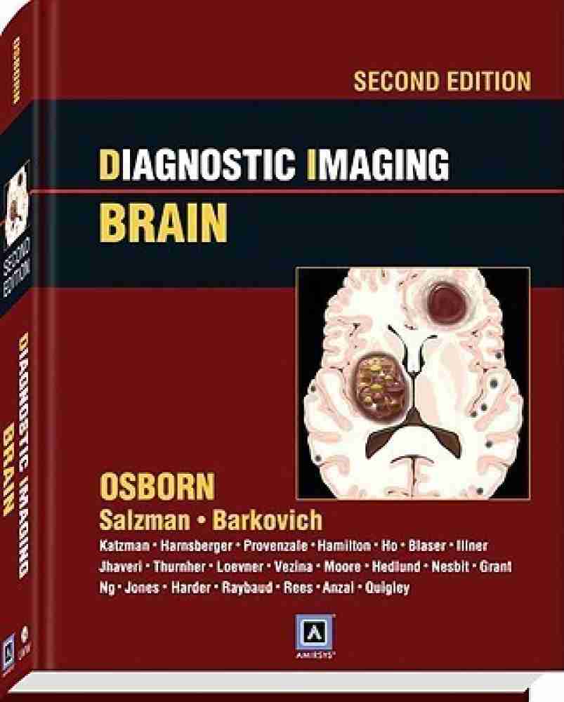 Diagnostic Imaging: Brain: Buy Diagnostic Imaging: Brain by Osborn 