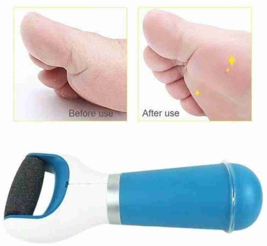 VKK TRADERS scrubber, Dead Skin and Callus Remover Perfect Electronic Dry  Foot File - Price in India, Buy VKK TRADERS scrubber, Dead Skin and Callus  Remover Perfect Electronic Dry Foot File Online