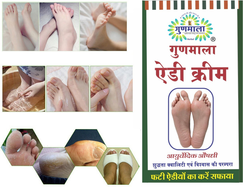 Crack heel discount treatment in hindi