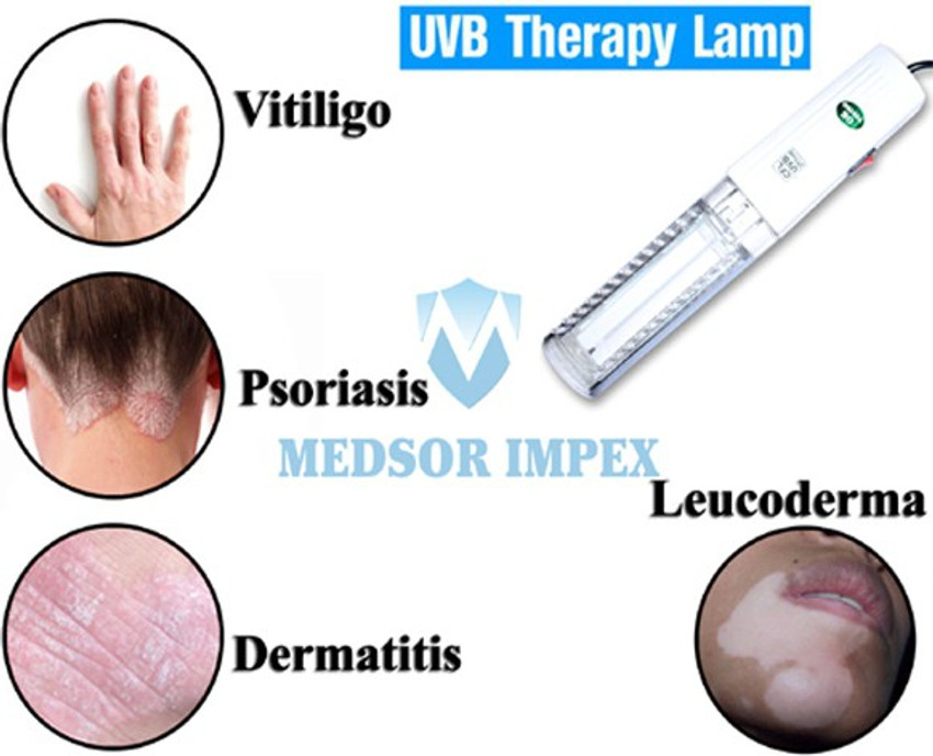 Uvb Light Therapy For Psoriasis Reviews Shelly Lighting