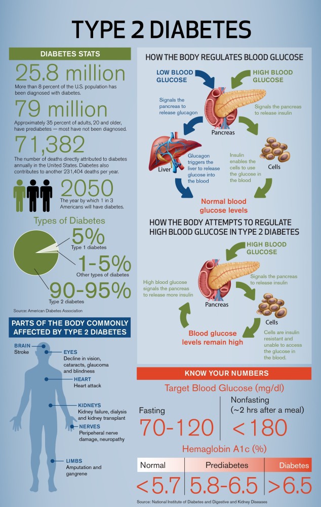 infographic poster diabetes mellitus