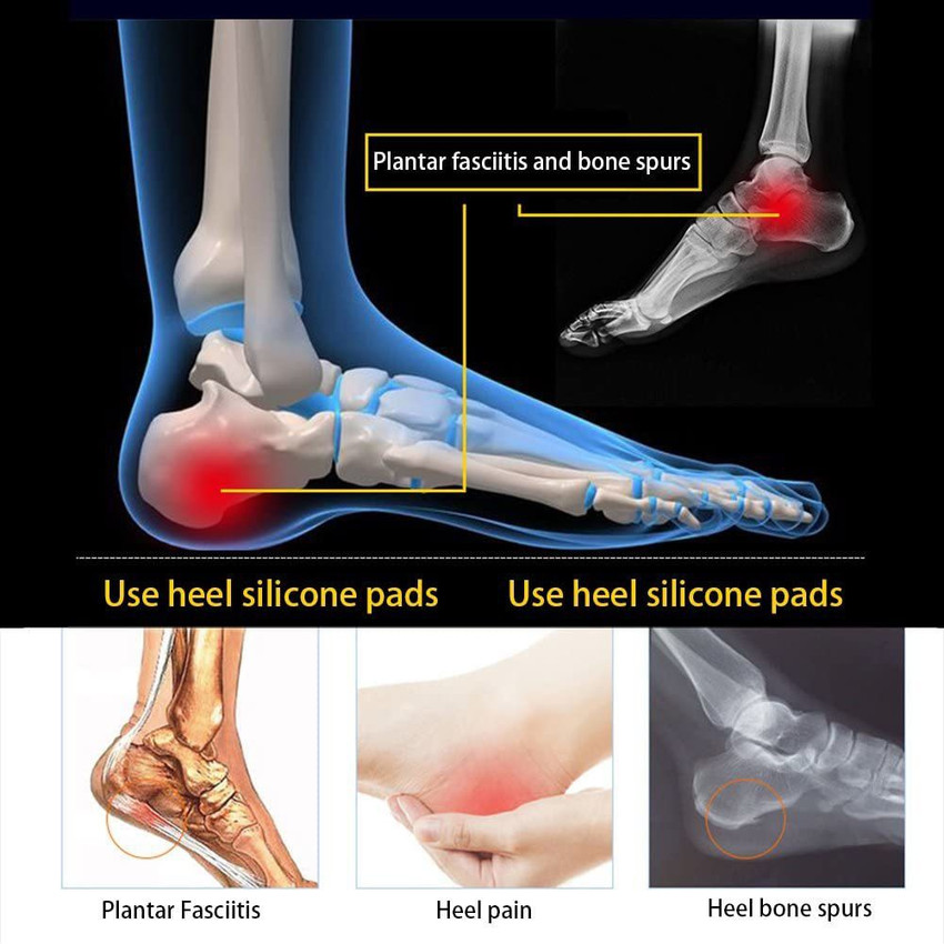 Heel bone spur shop support