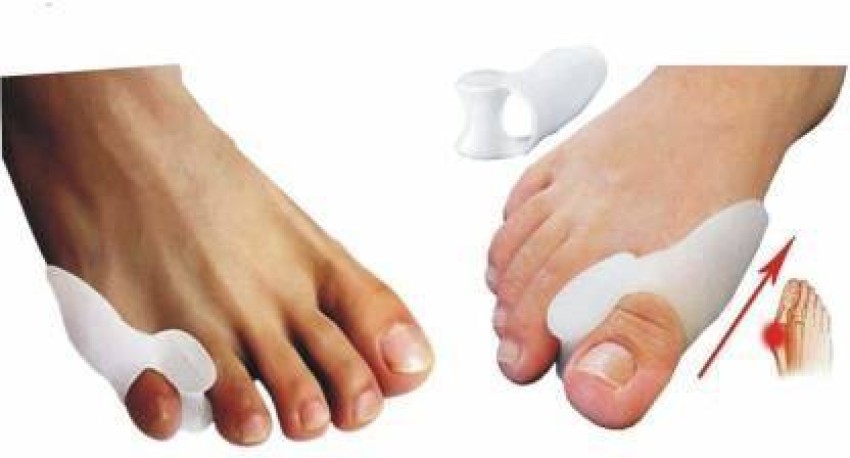 Welnove Toe Separators Bunion Corrector - Toe Spacers for Men Women to  Correct Bunions and Relieve Foot Pain - Silicone Toe Spacers for Toe