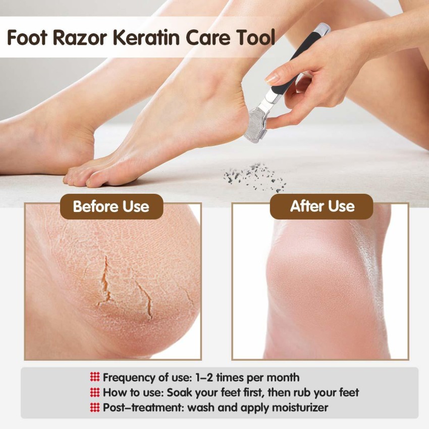 1pc Foot Dead Skin Removal Tool Foot Callus Shaver Stainless Steel