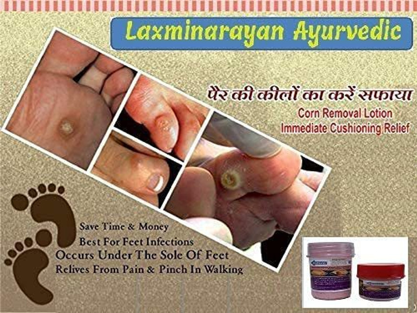 Best foot hot sale corn removal
