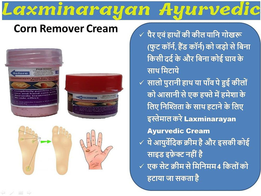 Allopathic medicine for foot corn shop