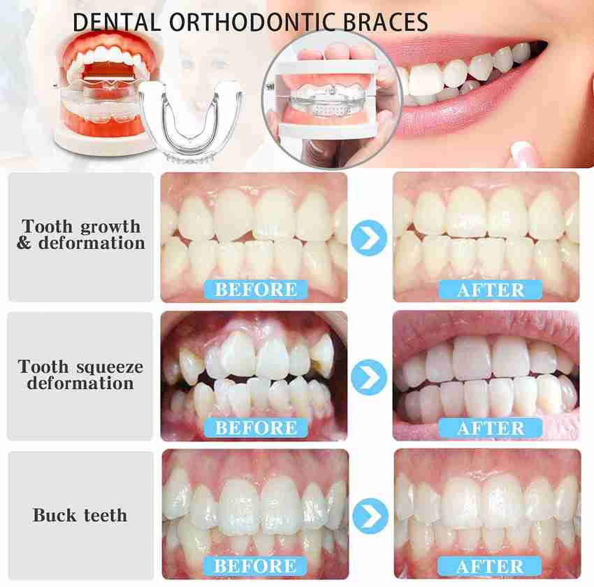 Teeth gap bands shop flipkart