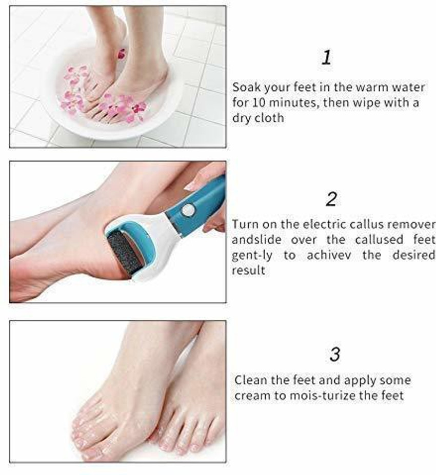 Foot hard skin remover cream top