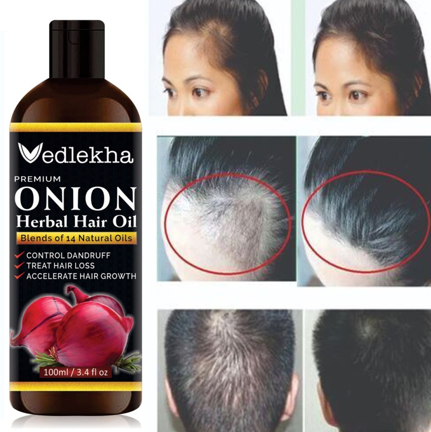 Proclues onion hair mask for Dandruff Hair Growth Hair Fall Hair Regrowth