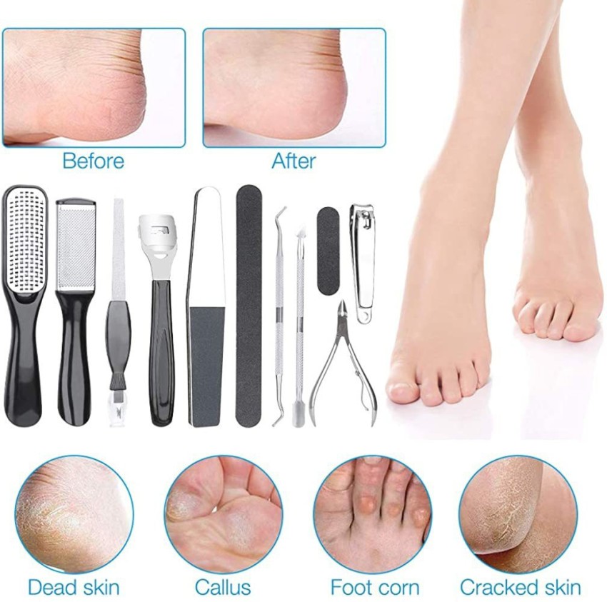 Foot File Colossal Foot Rasp Stainless Steel Pedicure Metal Surface Foot  Care Tool,Foot Rasp Eliminate Feet Cracked Dead Thick Dry Hard Skin (Black)
