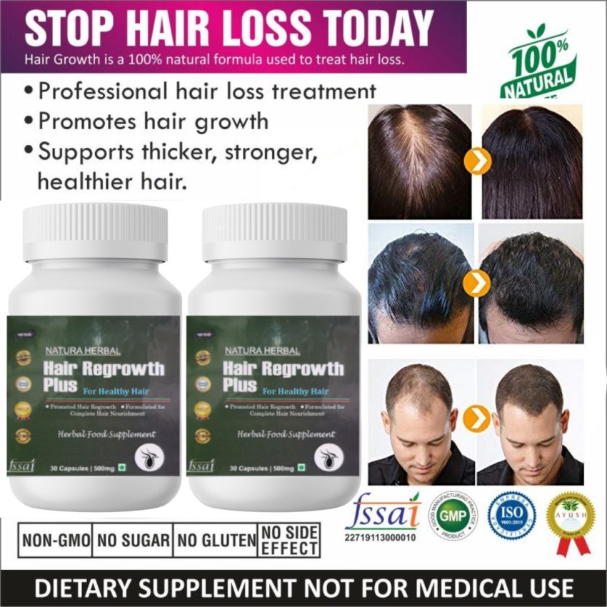 Details more than 152 hair regain capsules latest - POPPY