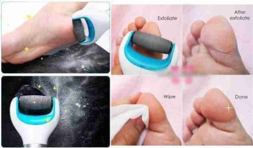 26Bst Feet Electronic Smooth and Soft Feet Pedicure Scrubber Cracked Heels Remover  Foot Skin Remover. - Price in India, Buy 26Bst Feet Electronic Smooth and  Soft Feet Pedicure Scrubber Cracked Heels Remover
