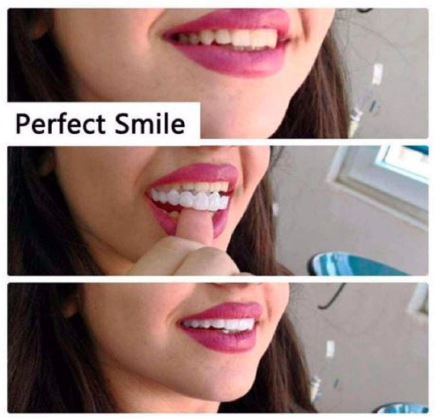 Perfect Smile Original