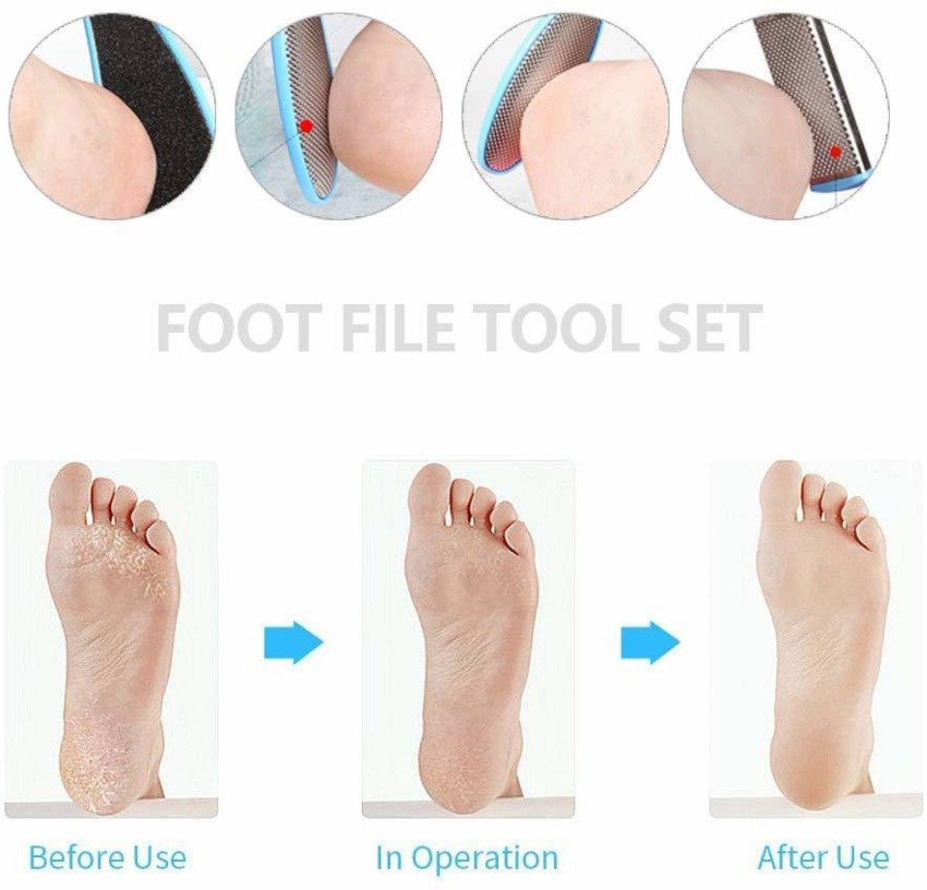 Buy HNB23 Foot File Set- Dead Hard Skin Callus Remover, Foot Scrubber For  Dead Skin.Portable Scraper Pedicure Rasp Tools,Foot Care Tool,Pedicure Tools,Foot  File (8 In 1) (200 g, Set of 8) (100