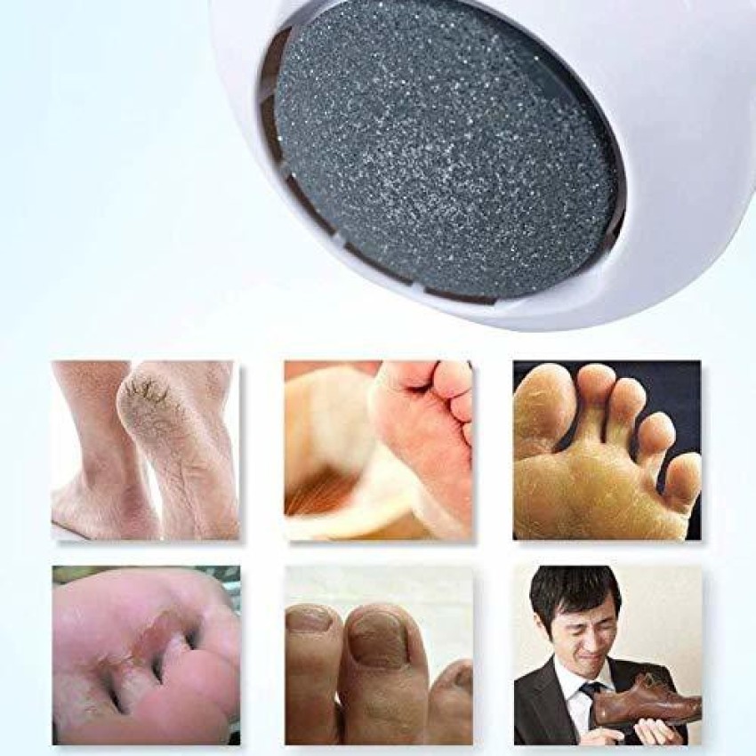 Foot Callus Remover, Electric Foot File Rechargeable Callus Dead Skin  Remover Plastic Foot Care Pedicure Tool Foot Sander Foot Care Grinding  Machine Removal Dry Hard Cracked Skin for Women Men 