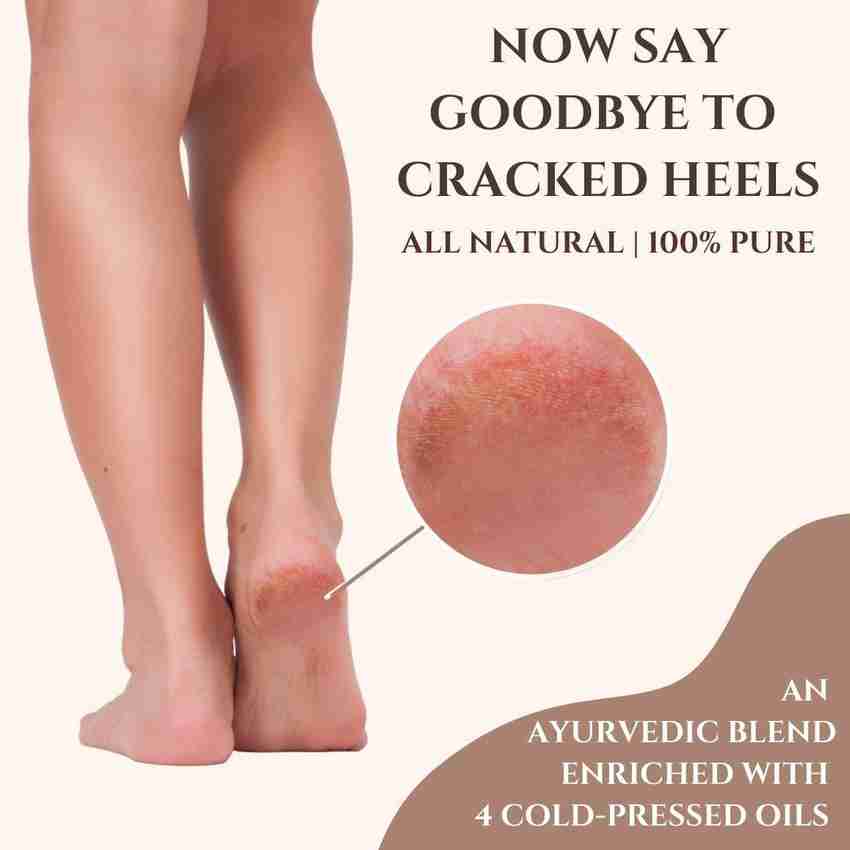 Best oil for cracked feet hot sale