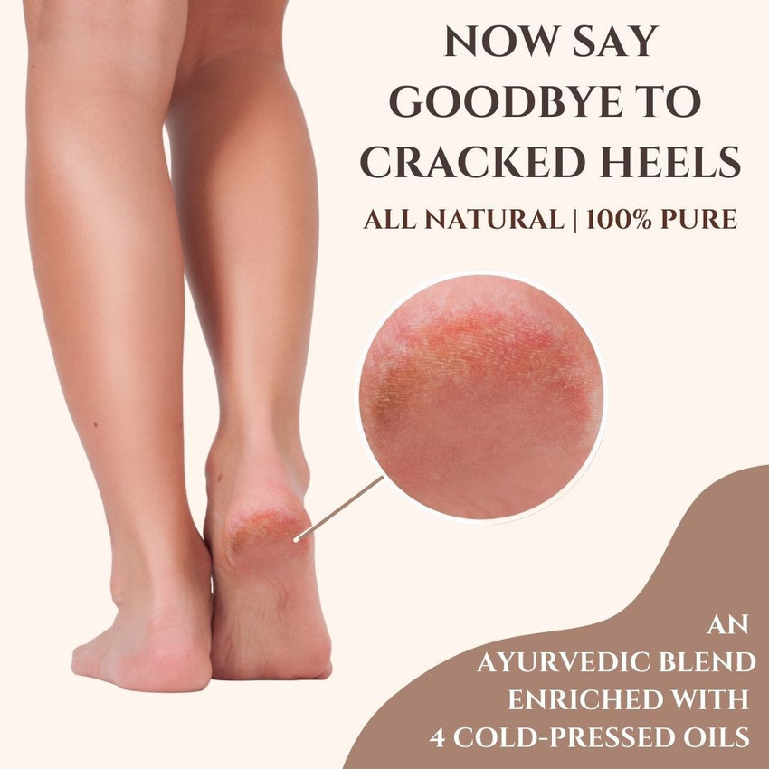 Repairing cracked new arrivals heels