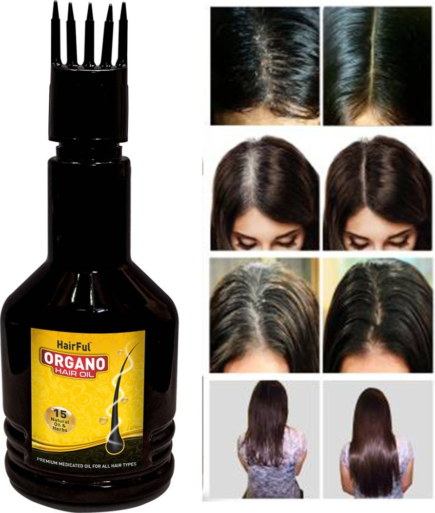 Buy Vigini Anti Dandruff Hair Oil 100ml  ShopHealthyin