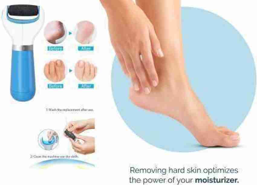 USEXIM Feet Care Callus Remover Pedicure Pedi for Hard Cracked Skin Foot Scrubber Roller Personal Pedi foot care callus remover tool system cracked heels pedicure brush feet spa kit machine set roller