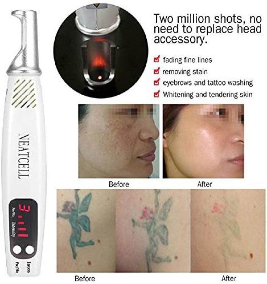 Plasma Laser Pen Age Spot Mole Warts Freckle Tattoo Removal Pen Skin Care  Device  eBay