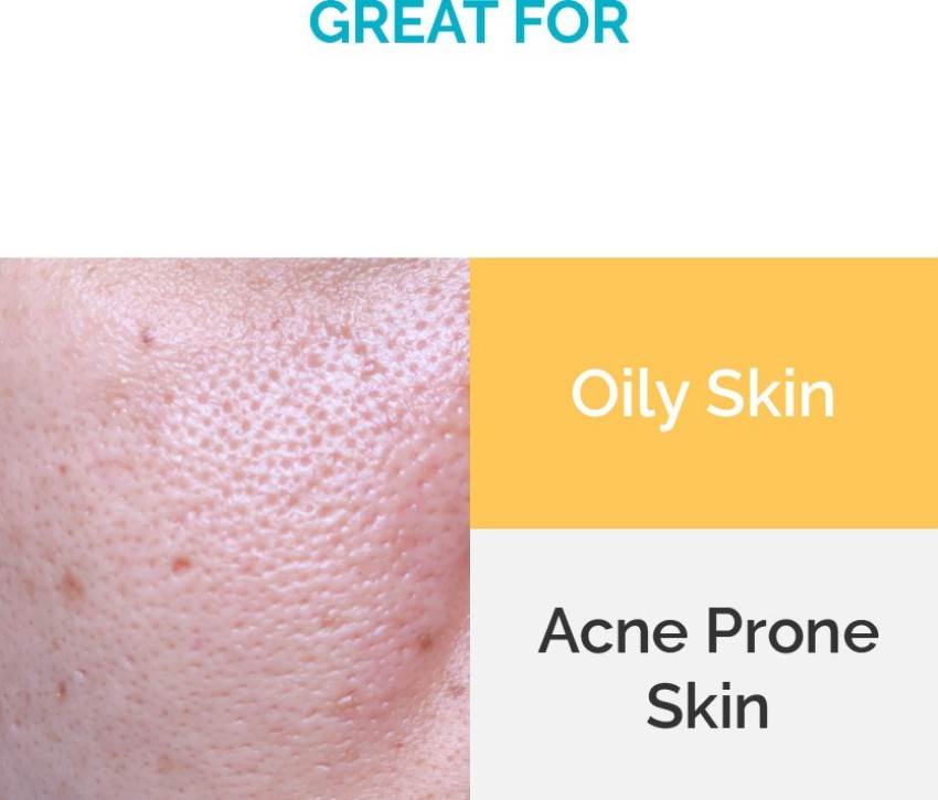 What Are The Different Types of Acne and How To Treat Them – SkinKraft