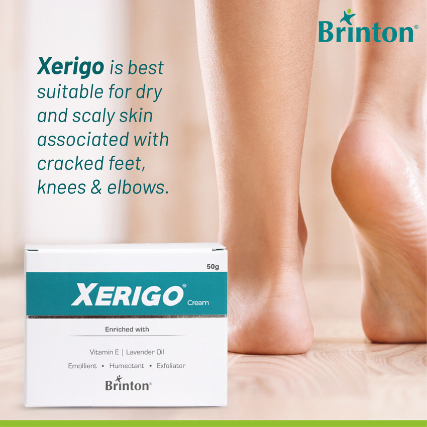 Brinton Xerigo Moisturizing Foot Care Cream For Rough Dry and Cracked Heel Prevents Moisture Loss Non Greasy Quick Absorbing Formula
