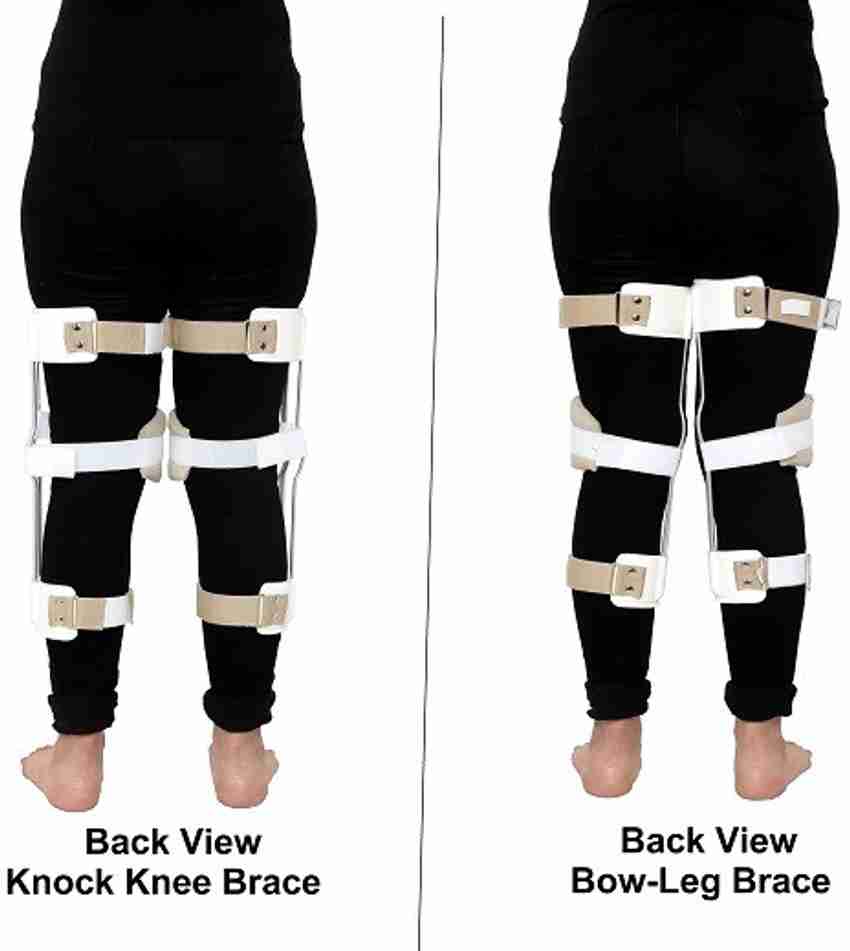 knock knees braces