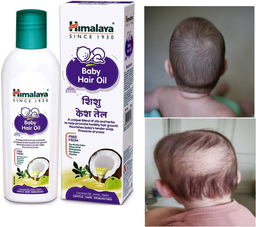 Buy Himalaya baby hair oil 100ml Online  Ayush Care