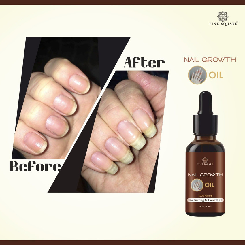 Top 145+ best oil for healthy nails best ceg.edu.vn