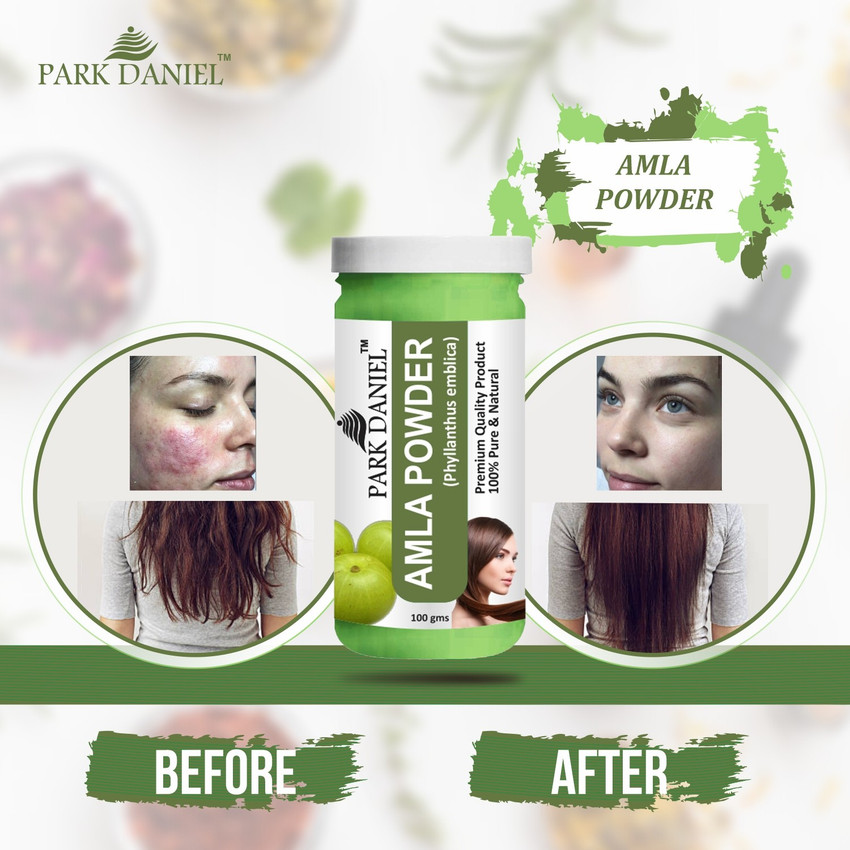 Aggregate 134+ amla juice for grey hair best tnbvietnam.edu.vn