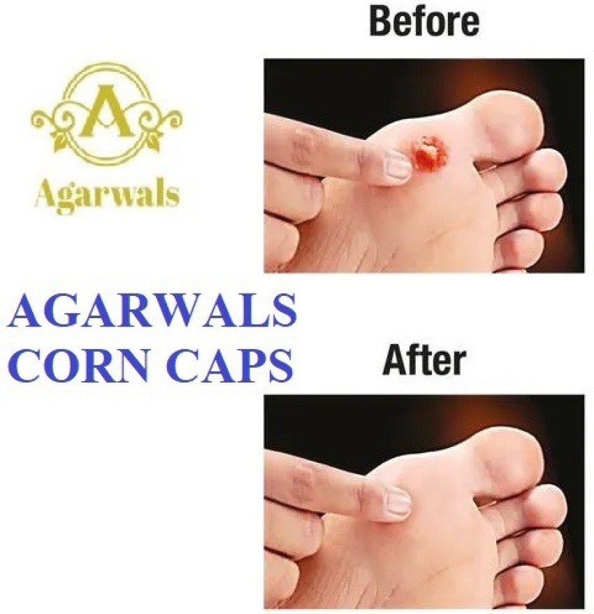 Agarwals Ated Corn Caps Plaster
