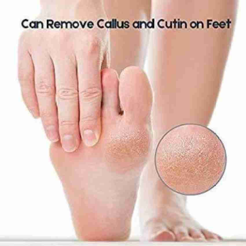 Pumice Stone - Callus and Dead Skin Remover 