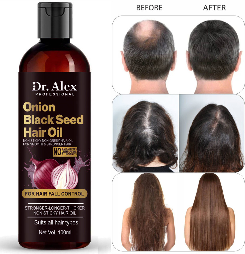 Share 171+ onion hair oil flipkart super hot tnbvietnam.edu.vn