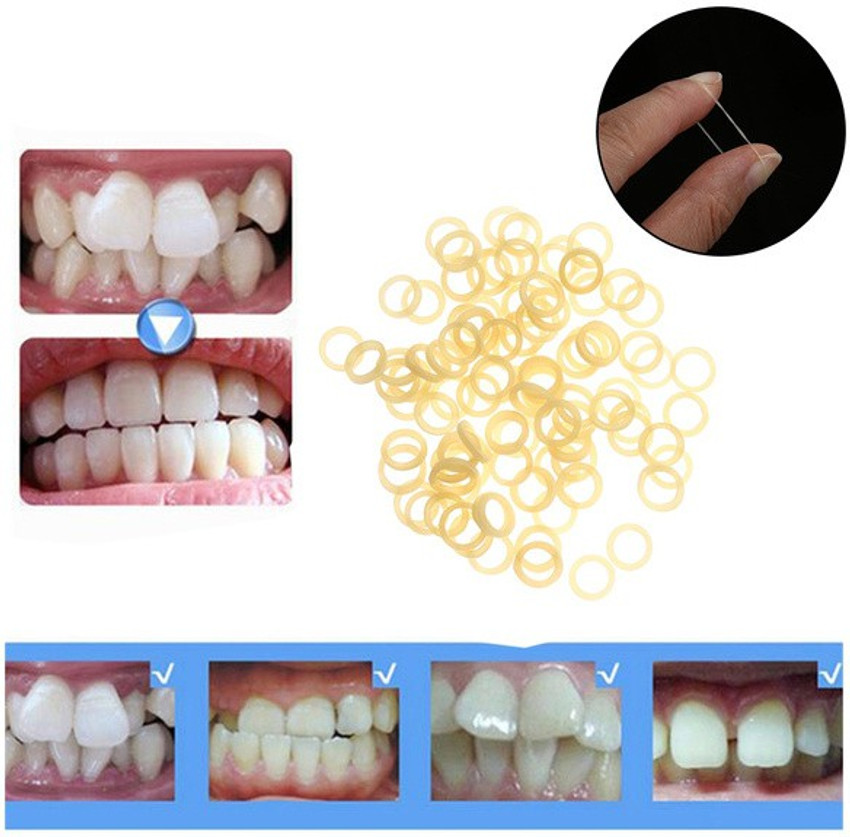Elastic bands clearance for teeth