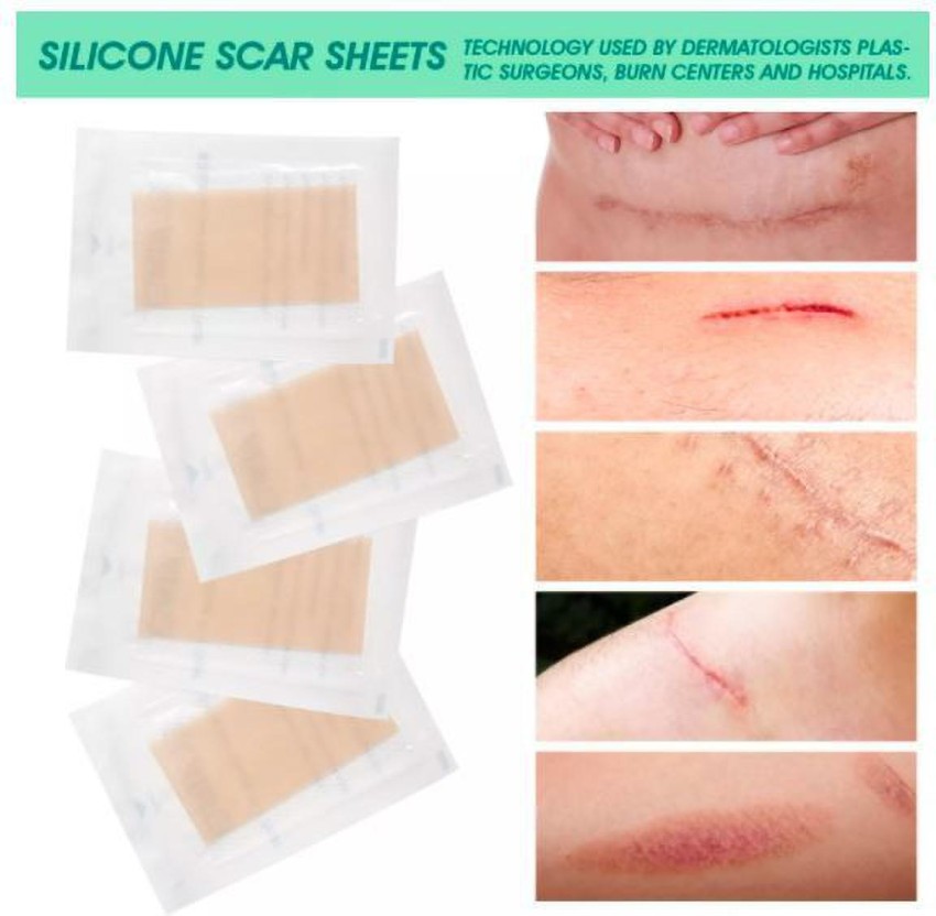 Elaimei 60'' Silicone Scar Sheets, Silicone Tape for Scars Removal 