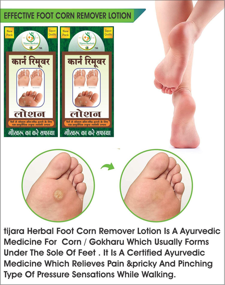 Ayurvedic medicine for foot sales corn