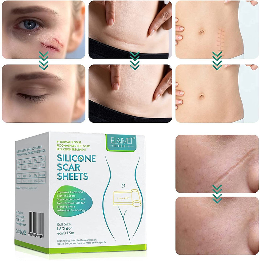 Scaraway silicone scar deals sheets