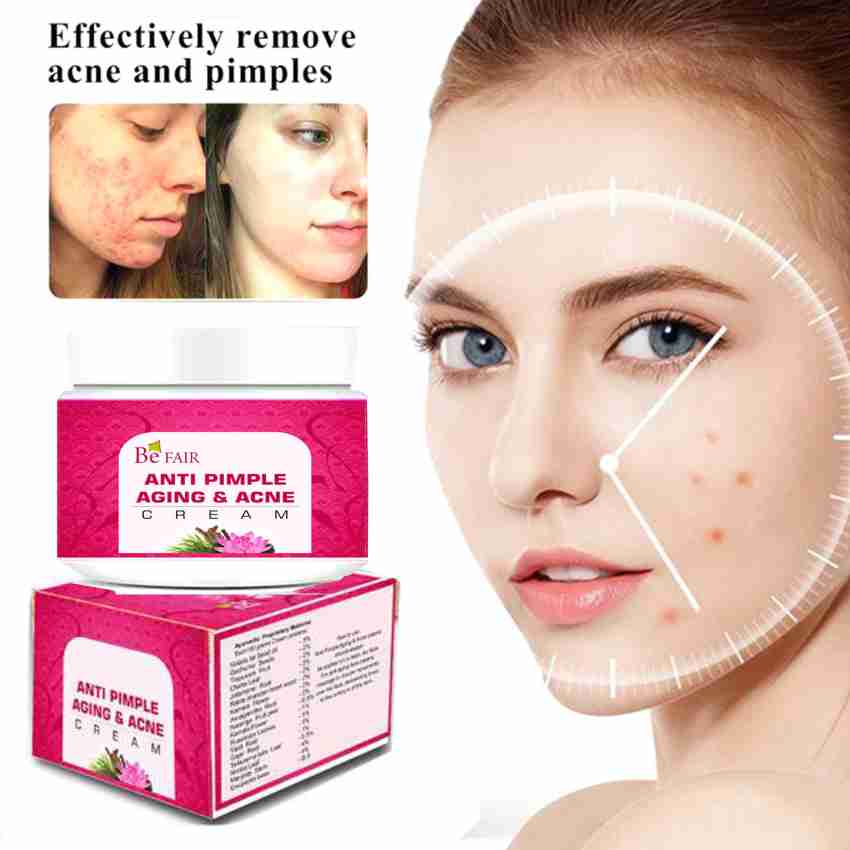Acne Treatment for Face, Acne Cream Back Acne  