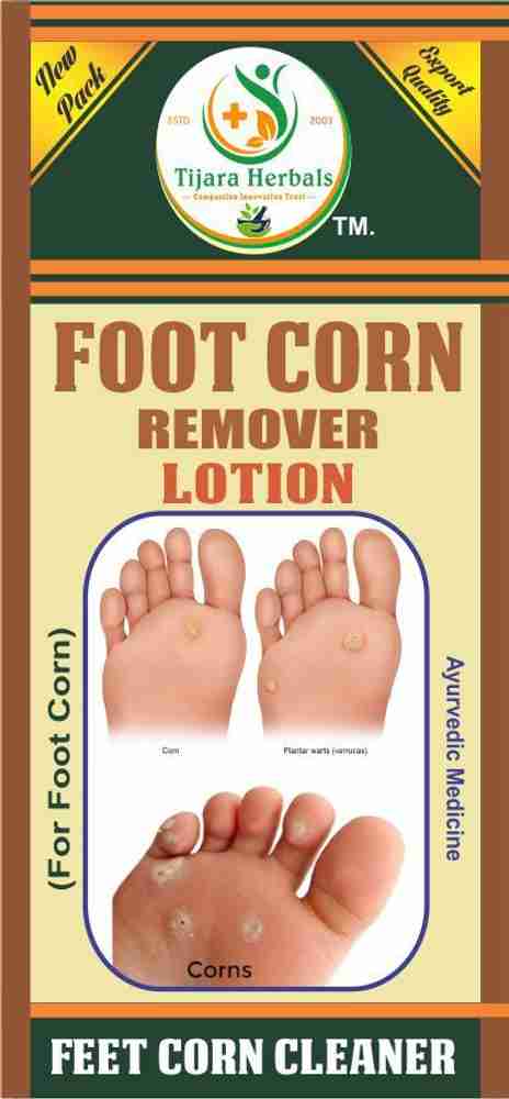 Ayurvedic medicine for corn in foot hot sale