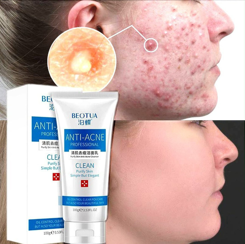 Anti blemish cleanser hotsell