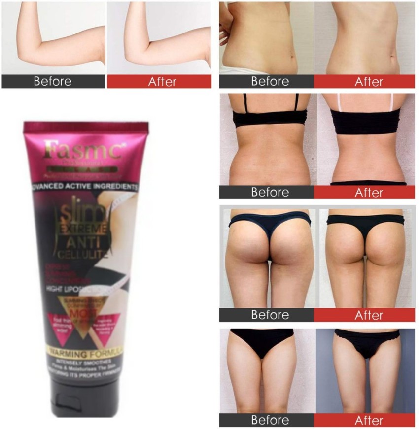 Cellulite be Gone With M&S' Firm Control Anti-Cellulite Waist and