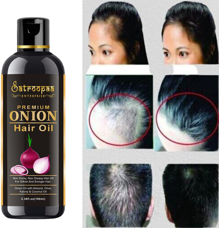Best onion top oil for hair