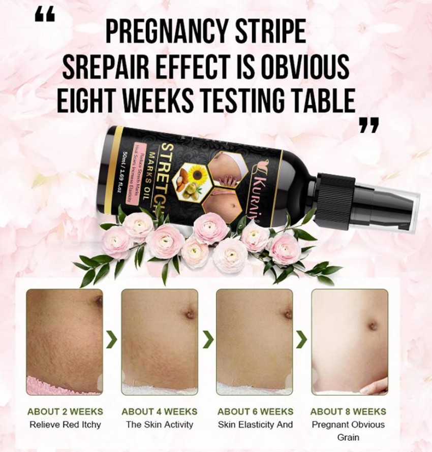 kuraiy Stretch Marks Oil to Minimize Stretch Marks & Even Out Skin