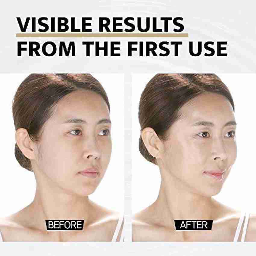 Face Lifting Mask Silicone V Line Shape Facial Slimming Bandage Mask Cheek  Chin Neck Slimming at Rs 200, MASSAGERS in Mumbai