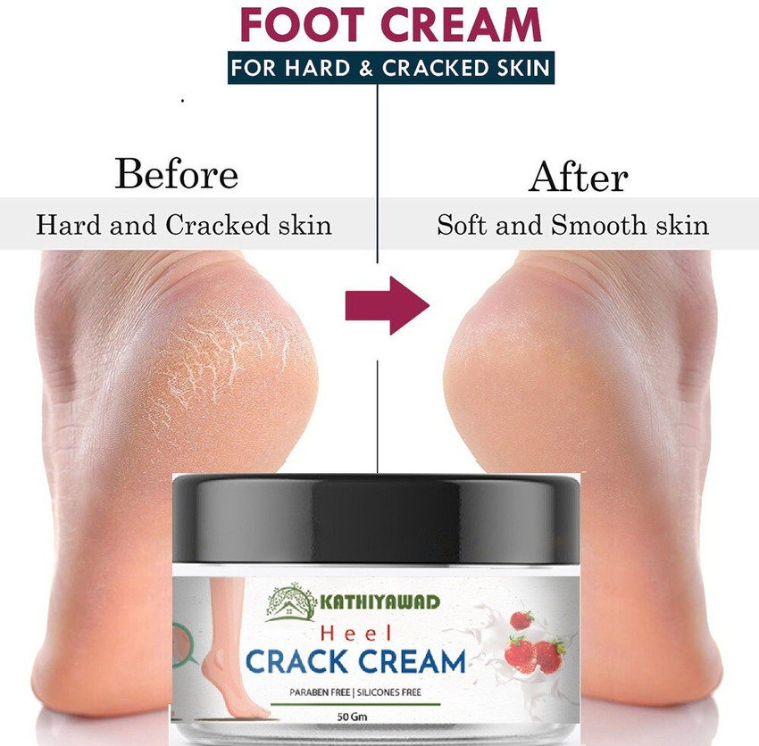 Leg discount crack cream