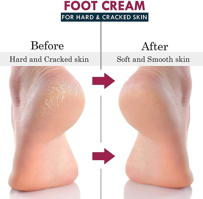 7 FOX Natural Foot cream for cracked heels repair softening foot care cream Men Women Price in India Buy 7 FOX Natural Foot cream for cracked heels repair softening foot